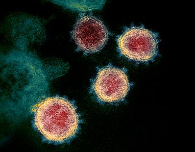 Coloured micrograph of corona virus