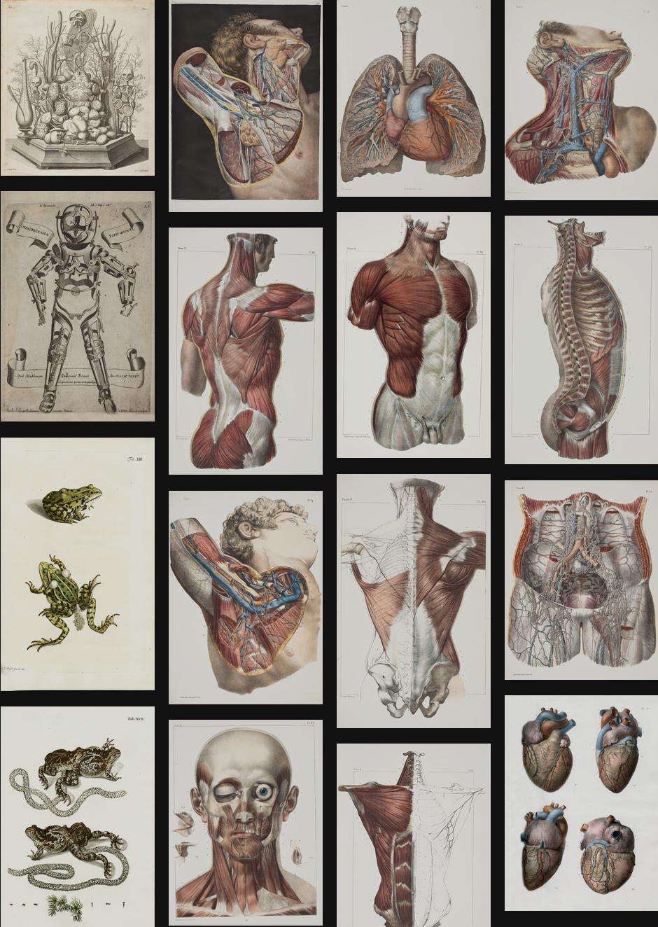 Sample of the hagströmer Library image gallery