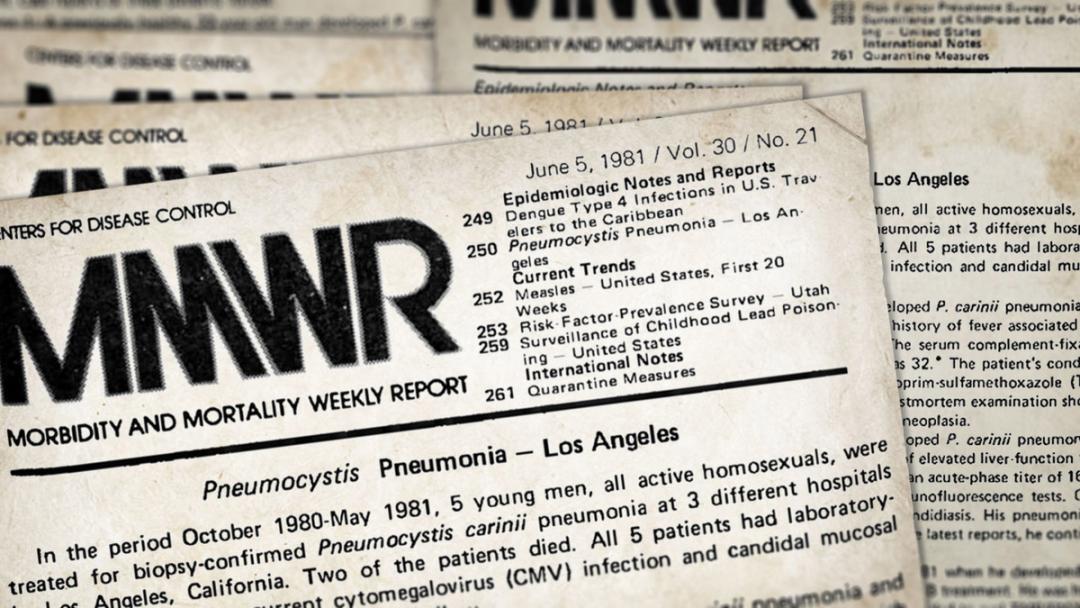 Bild av urklipp från tidning från 1981 med notis om de första fallen av den sjukdom som senare kom att benämnas aids.