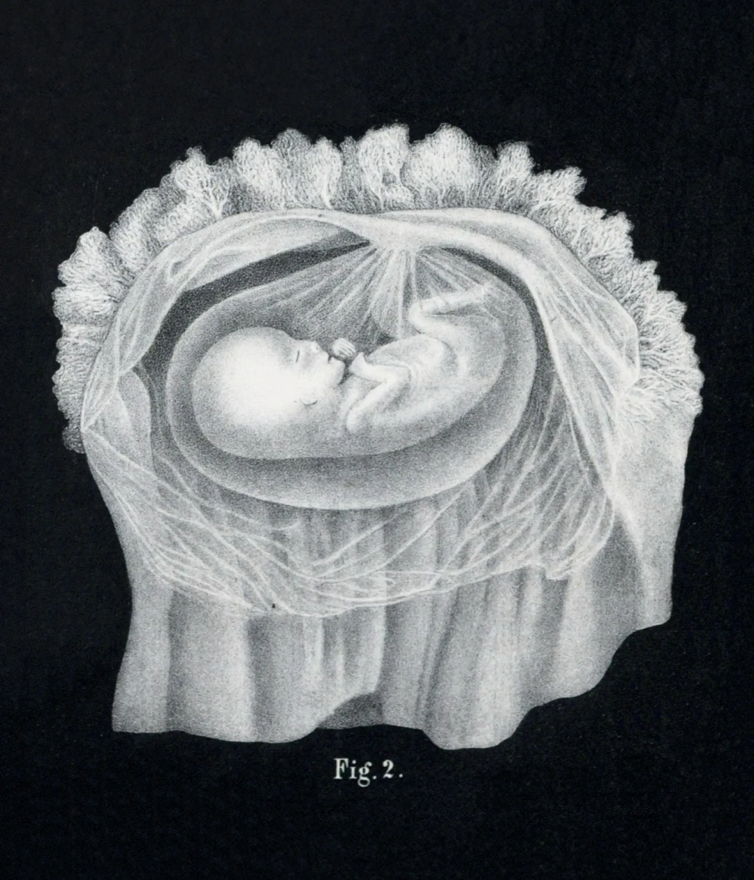 The Fragility of Life