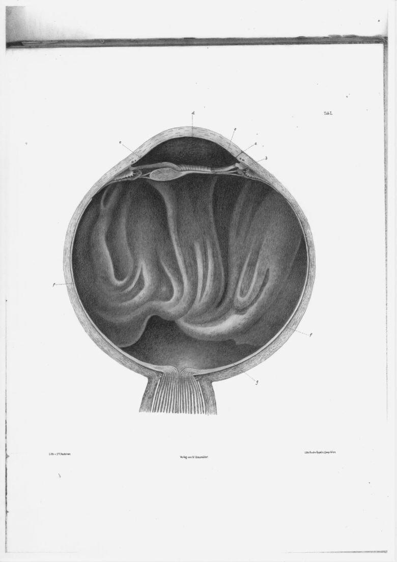 Vitreous Bodies Exhibition